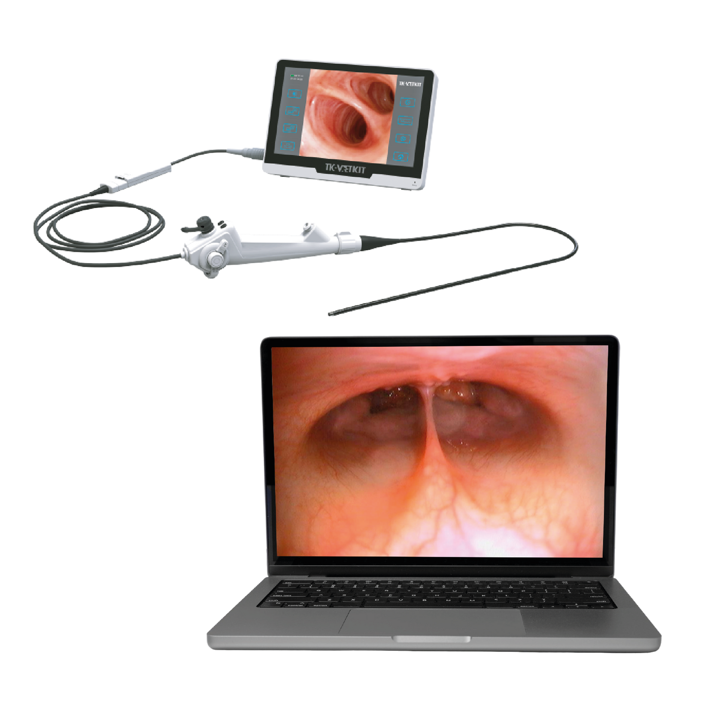 Adaptateur pour endoscope