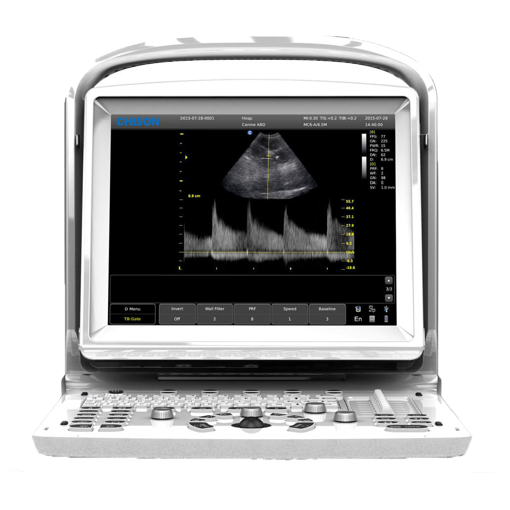 Echographe Chison ECO3 Expert