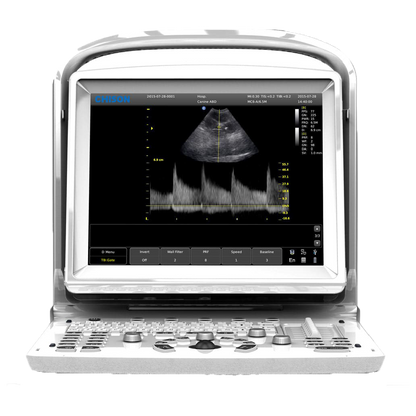 Echographe Chison ECO3 Expert